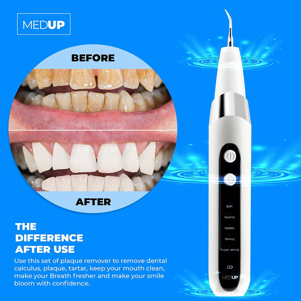 Electric Plaque Remover for Teeth, Ultrasonic Dentist Tools for Calculus, Tarter, and Stain Remover , Teeth Cleaning Kit - Medup