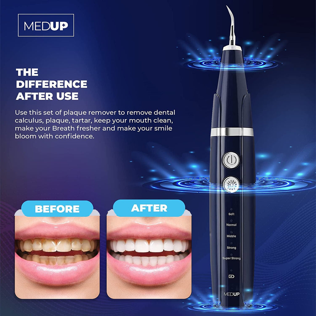 Plaque Remover for Teeth, Ultrasonic Dental Tools for Calculus, Tarter, and Stain Remover , Electric Teeth Cleaning Kit - Medup